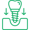 dental-implant