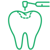tooth-filling